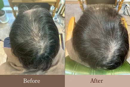 60代女性 髪と頭皮のリバースエイジング Before/After