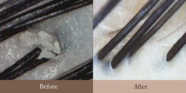 頭皮の施術前後 Before/After — 皮脂で汚れている頭皮が健康な頭皮に