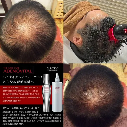 髪育コースで使用する資生堂アデノバイタルと施術イメージ