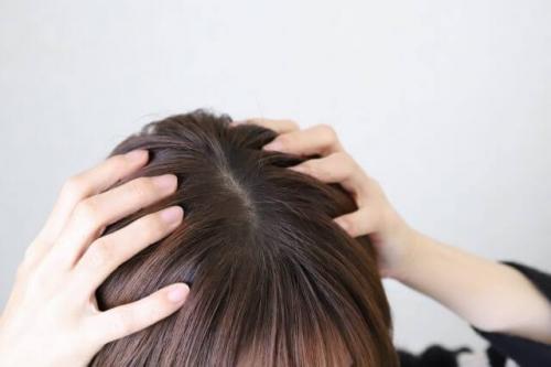【春の頭皮トラブル。正しいケアで快適な季節を過ごしましょう】