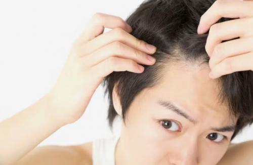 【薄毛が気になり始めた男性へ｜岡山市南区で相談できる理美容室】